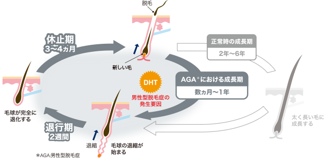 AGAヘアサイクル